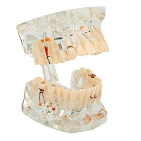 上顎/下顎のモデル 歯 模型 歯形模型 歯列 模型 歯形 模型 透明 研究指導 樹脂 歯科学習 教育 研究ツール 指導 教育 練習 デモンスト