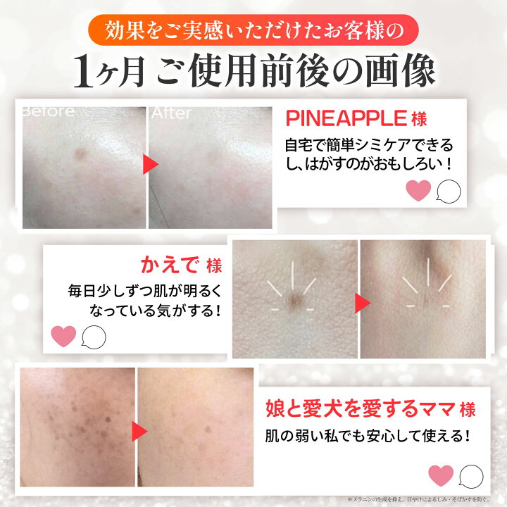 ５０代からの顔のシミ・重曹でシミを除去 - 美白効果のある成分とは