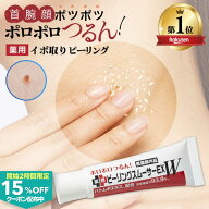 【 イボ取り 薬用 ピーリング 自宅で簡単 累計35万本 】 イボ クリーム 首イボ ヨクイニン イボ取りクリ…