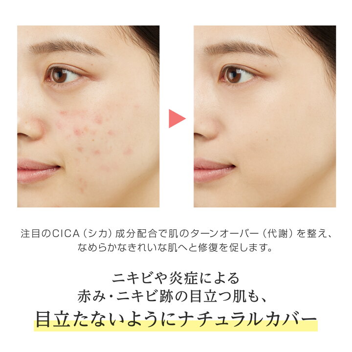 Grangrade( グラングレイ 薬用 CICAクリーム BB シカクリーム 日本製 無添加 シカ BBクリーム ニキビケア ニキビカバー ニキビ跡 肌荒れ防止 石けんで落とせる ファンデ 肌荒れ 敏感肌 UVケア 保湿 マスクにつかない コスメジタンショップ シカ配合☘ニキビケアクリーム 1個 ニキビ跡 クレーター 妊娠線 ニキビパッチ