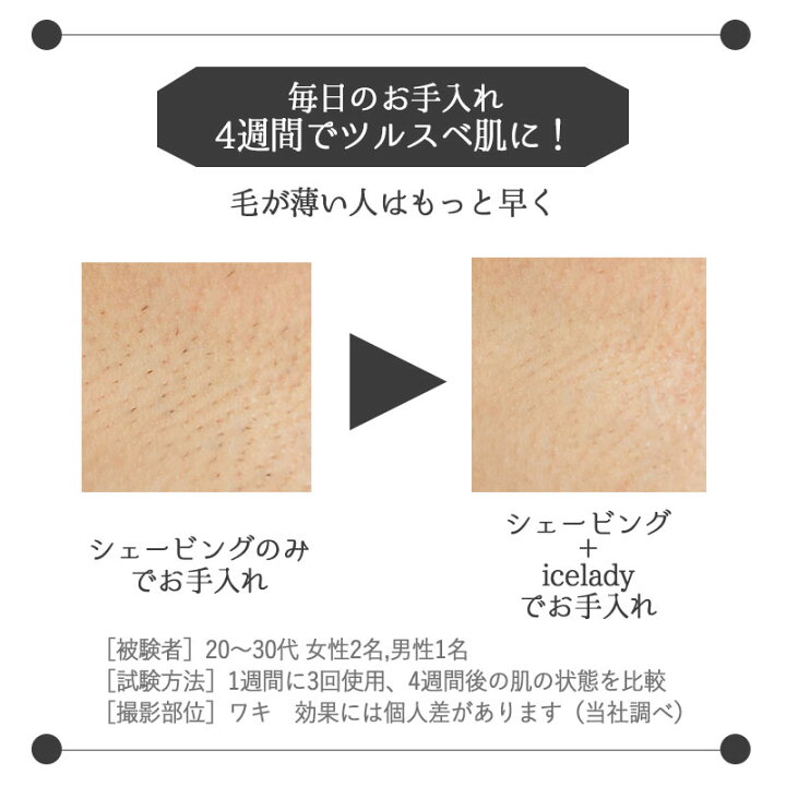 楽天市場】Notime icelady アイスレディ 全身脱毛器 家庭用光美容器 