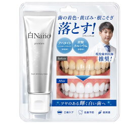 \ 現役歯科医師と共同開発 /ホワイトニング 歯磨き粉 ホームホワイトニング 自宅 効果 頻度 おすすめ 歯が白くなる ドラッグストア 白くなる 歯 効果 ランキング 市販 歯医者 海外 口コミ 白く なる 口臭予防 人気 歯のホワイトニング 歯科医 市販 ランキング 毎日 セルフ