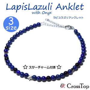 X^[ `[ sXY ANbg  4mm VR p[Xg[ IjLX ANbg ~TK Y fB[X yAANbg nCAWG[ T[t@[ sX