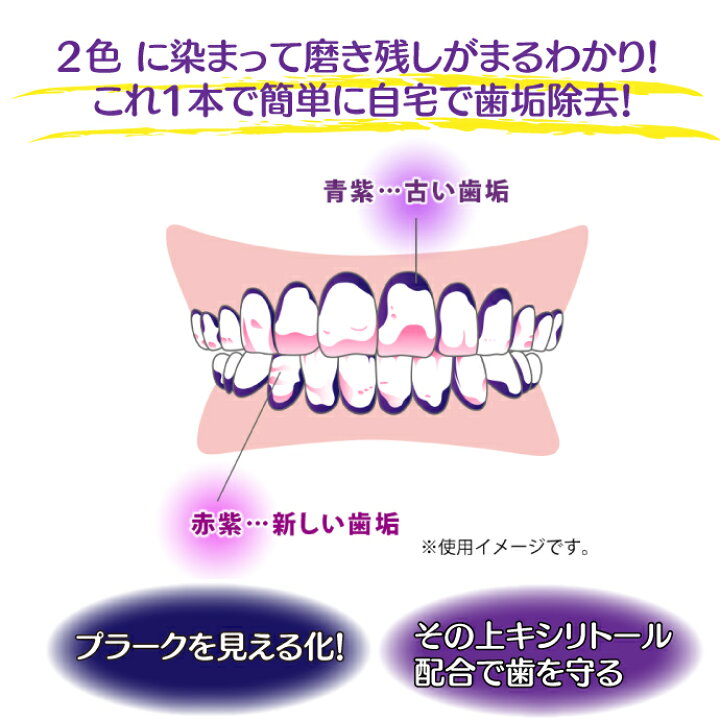 爆買いセール ほぼ未使用 プラークチェッカー グレープ味 歯垢染色液 キシリトール配合 kochi-ot.main.jp