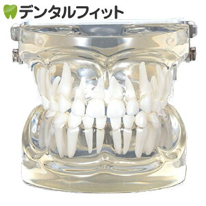 透明乳歯 永久歯交換期模型 乳歯期(3歳頃) 【送料無料】
