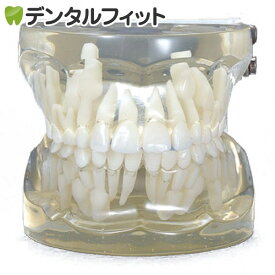 【送料無料】透明乳歯 永久歯交換期模型 永久歯交換期(7～9歳頃)