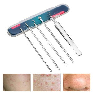 nalainapy5{ZbgzjLrєьPApLbgݎjLrjRۃXeXgѕ֗[P[Xtec[epi