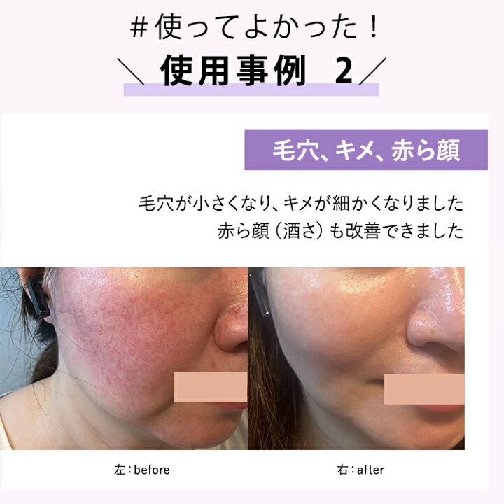 楽天市場】【☆P10倍】セット商品 Denshindo プラズマ エアシャワー 