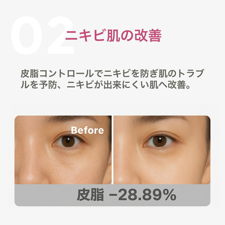 楽天市場】美顔器 リフトアップ 7色 LED美容器 LEDマスク 美顔マスク 