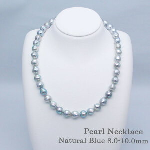 Fa^ p[lbNX i`u[ 8-10.0mm ^ y^ QSݓX