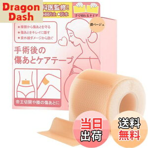 yzye畆Ȉ㐄zՃPAe[v 鉤؊J e[v PCh΍p p̏ƕی wh×ɂ₳xVRWFV[gwŐ؂^Cvxi4cm×150cm