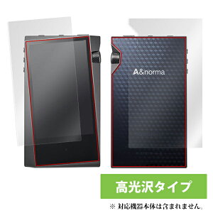 �y�����񂹁z�~���r�b�N�X OverLay Brilliant for A&norma SR15 �w�\�ʁE�w�ʃZ�b�g�x