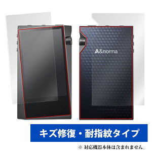 �y�����񂹁z�~���r�b�N�X OverLay Magic for A&norma SR15 �w�\�ʁE�w�ʃZ�b�g�x