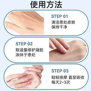 ���e�t ���� 20g �q�A�������_ �z�� �X�L���P�A �����Ƃ�