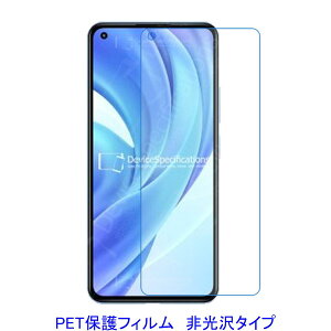 y2z VI~ Xiaomi Mi 11 Lite 5G 6.55C` tیtB  wh~