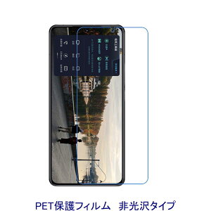 y2z Redmi K70 Xiaomi 14T 14T Pro POCO X6 Pro X7 Pro F7 Pro F7 Ultra tیtB  wh~