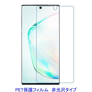 y2z Galaxy Note 10 ʂ̂ݕی tیtB  wh~