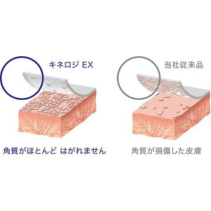 (LINE�N�[�|���L)4904140519223 �j�g���|�g �L�l���WEX NKEX50 6�}�L�C�� NKEX50