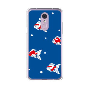 LG Q Stylus 801LG/LM-Q710XM���� �P�[�X/�J�o�[ �y�����h�b�g �N���A�P�[�X�f�ށzLG Q�X�^�C���X �J�o�[ LMQ710XM ���C���o�C�� �y�V���o�C�� LGQStylus