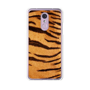 LG Q Stylus 801LG/LM-Q710XM���� �P�[�X/�J�o�[ �y�g���� �N���A�P�[�X�f�ށzLG Q�X�^�C���X �J�o�[ LMQ710XM ���C���o�C�� �y�V���o�C�� LGQStylus