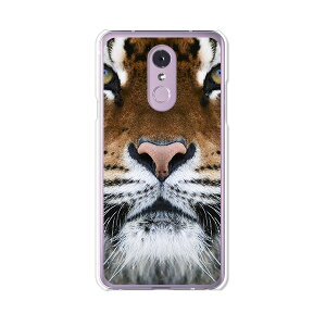 LG Q Stylus 801LG/LM-Q710XM���� �P�[�X/�J�o�[ �yTIGER �N���A�P�[�X�f�ށzLG Q�X�^�C���X �J�o�[ LMQ710XM ���C���o�C�� �y�V���o�C�� LGQStylus