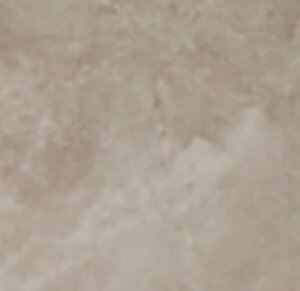 OBiNX@IPF-300/GVN-2[P[X]@300mmp@O^C