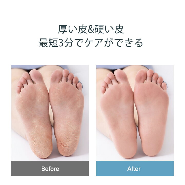 楽天市場 角質ケア 8点セット Dg Ft8h1 送料無料 フットケア 魚の目 たこ コーンスライサー 甘皮処理 ネイル ニッパー プッシャー セット 爪 ケア キューティクル メタルプッシャー ささくれ 前処理 セルフ ネイル バッファー 爪やすり Eye Love