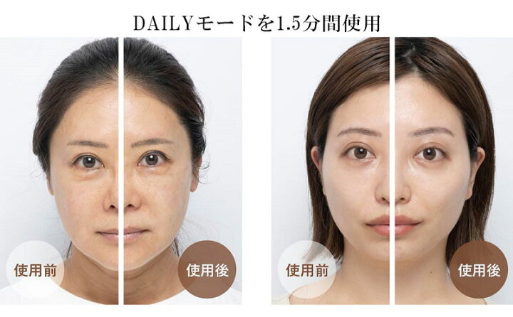 楽天市場】【ふるさと納税】ヤーマン RF美顔器 フォトプラス 