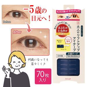 tgAbv ACe[v 35 l ܂Ԃ  ȒP  g |5 yX { 邢 Жʃe[v  V  wl ڐK ӂ Ԃ yKiz/l̃tg