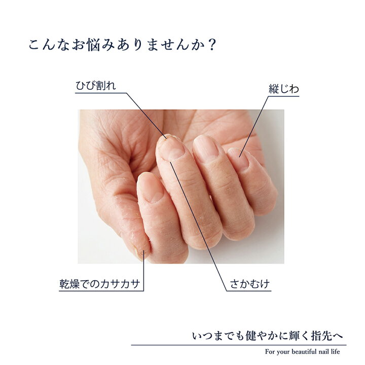 楽天市場 Nailbase ネイルベース 甘皮オイルと爪の美容液のセットネイル 天然オイル ネイルケア 自爪 セルフネイル セルフケア 国産 自爪 ケアグッズ 女性 男性 プチギフト お返し ギフト あす楽対応 M便 1 10 ギフト雑貨 Anniversary World