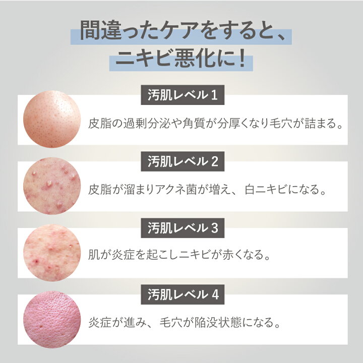 楽天市場】【 公式 】【デリケートな思春期のお肌に】 トワニエール 