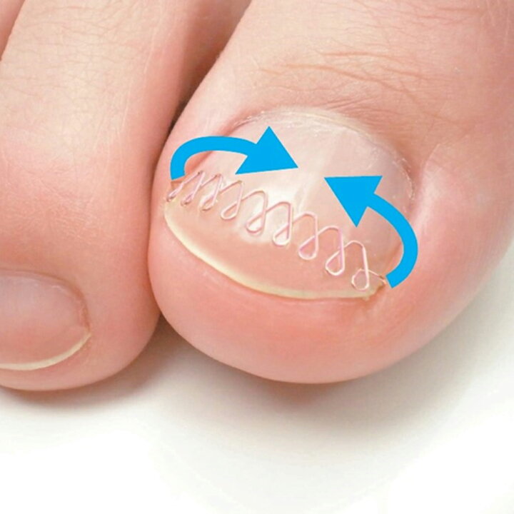 巻き爪ロボ Bタイプ 巻き爪ブロックハードセット カラー