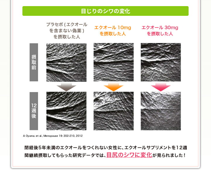 \ご注文殺到☆限定5,000円オフ!/エクオール検査キット『腸内博士』ビューティー〜エクオールプラス〜 エストロゲン イソフラボン サプリ 更年期 女性 ファインシード \ご注文殺到★限定5,000円オフ!/エクオール検査キット『腸内博士』ビューティー〜エクオールプラス〜 エストロゲン イソフラボン サプリ 更年期 女性
