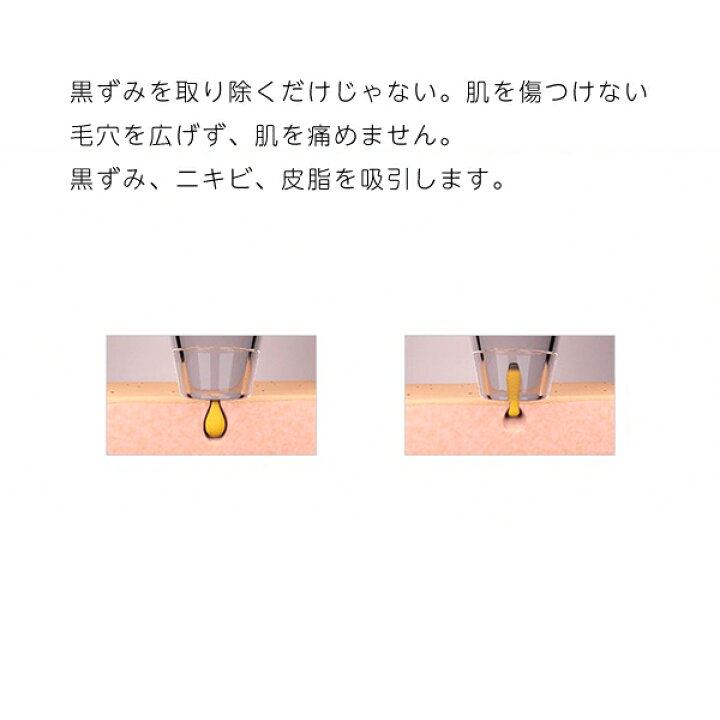楽天市場】【ポイント10倍】Bosidin 毛穴吸引器 毛穴クリーナー（ICE 