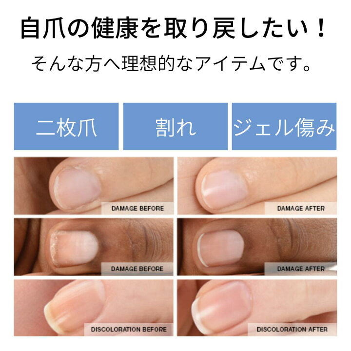 楽天市場 期間限定クーポン配布中 宅配送料無料 Zoya ゾーヤ ネイキッドマニキュア プロフェッショナルキット ネイキッドベース サテンシール グロッシーシール Zp784 Zp785 Zp786 Zp787 Zp7 Zp7 各15ml ナチュラル 自然 セット マニキュア通販 大人ネイル