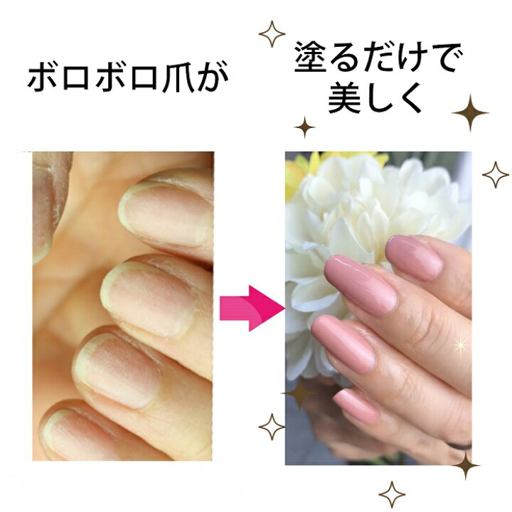 楽天市場 期間限定クーポン配布中 爪割れ Opi 育爪マニキュアセット ケアベース ぷっくりトップ カラー ネイルオイル ジェルブレイク プランピング 人気カラー 選べる プロスパ トゥゴー ペンタイプ ネイルケア 宅配送料無料 マニキュア通販 大人ネイル 楽天市場 期間限定クーポン配布中 爪割れ Opi 育爪マニキュアセット ケアベース ぷっくりトップ カラー ネイルオイル ジェルブレイク プランピング 人気カラー 選べる プロスパ トゥゴー ペンタイプ ネイルケア 宅配送料無料 マニキュア通販 大人ネイル