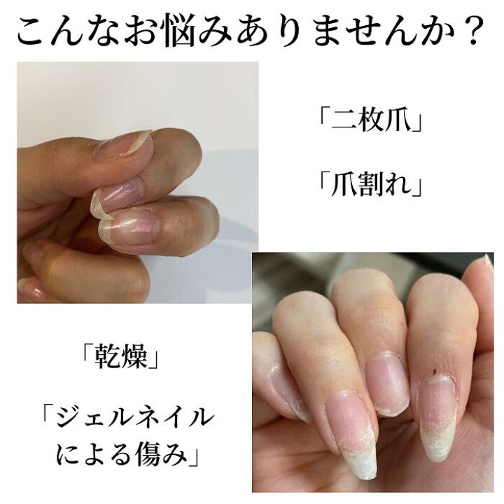 楽天市場 期間限定クーポン配布中 爪割れ Opi 育爪マニキュアセット ケアベース ぷっくりトップ カラー ネイルオイル ジェルブレイク プランピング 人気カラー 選べる プロスパ トゥゴー ペンタイプ ネイルケア 宅配送料無料 マニキュア通販 大人ネイル 楽天市場 期間限定クーポン配布中 爪割れ Opi 育爪マニキュアセット ケアベース ぷっくりトップ カラー ネイルオイル ジェルブレイク プランピング 人気カラー 選べる プロスパ トゥゴー ペンタイプ ネイルケア 宅配送料無料 マニキュア通販 大人ネイル