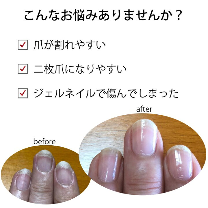 楽天市場 宅配送料無料 Opi ネイルエンビー爪割れ 防止ケアセット トライアル 爪強化 割れる 二枚爪 育爪 ネイルケア ネイルケア キューティクルオイル プロスパ 大人 ネイル アセトンフリーリムーバー マニュアル 乾燥 ささくれ 対策 マニキュア通販 大人ネイル