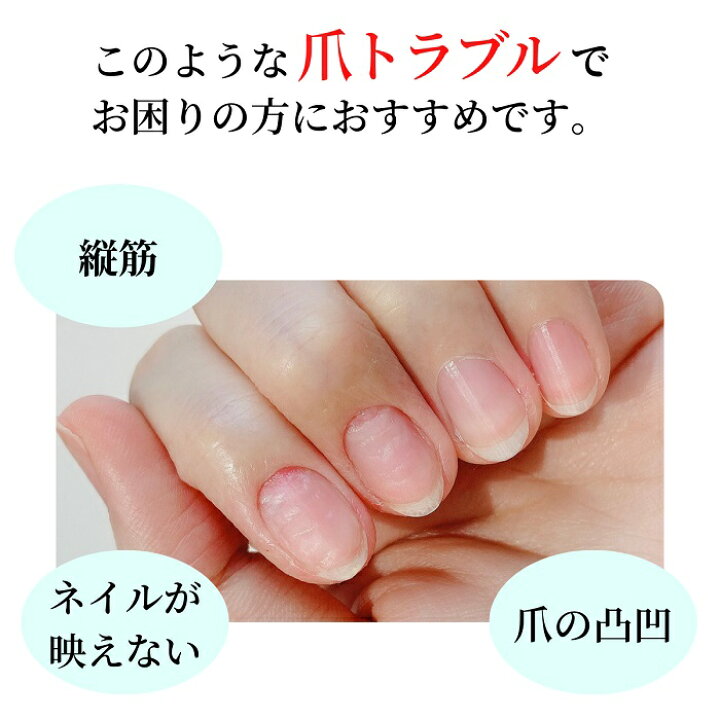 楽天市場 期間限定クーポン配布中 Opi Infinite Shine インフィニット シャイン Is T12 リッジフィラー ケアベースコート Opi マニキュア 速乾 ネイルケア 縦筋 凹凸 マニキュア通販 大人ネイル