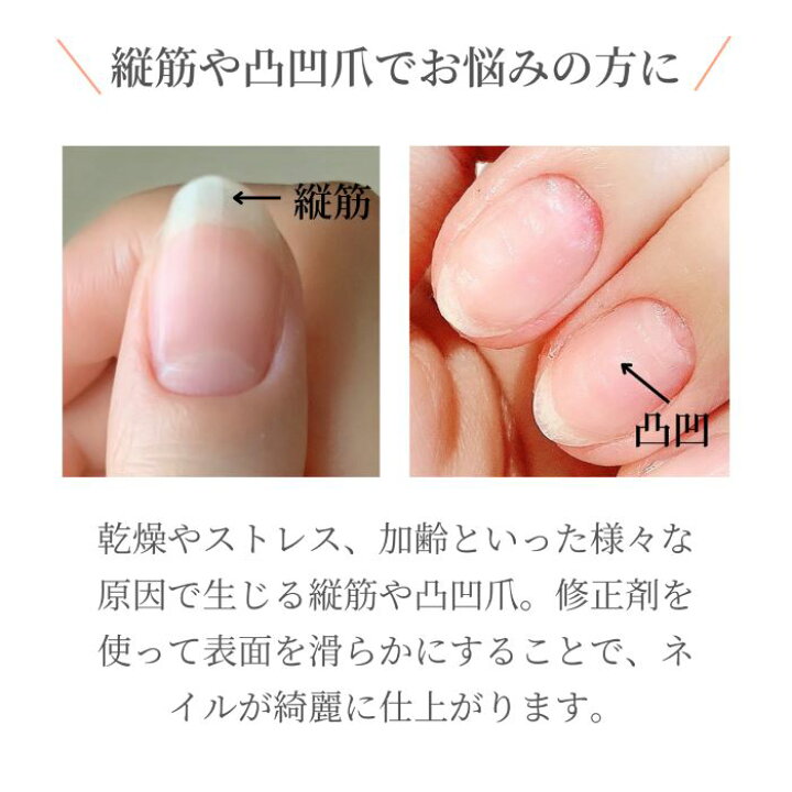 楽天市場 期間限定クーポン配布中 Noiro ノイロ リッジコンシーラー W ホワイト 11ml 爪に やさしい マニキュア セルフネイル ベースコート 凹凸 なめらか マニキュア通販 大人ネイル 楽天市場 期間限定クーポン配布中 Noiro ノイロ リッジコンシーラー W ホワイト 11ml 爪に やさしい マニキュア セルフネイル ベースコート 凹凸 なめらか マニキュア通販 大人ネイル