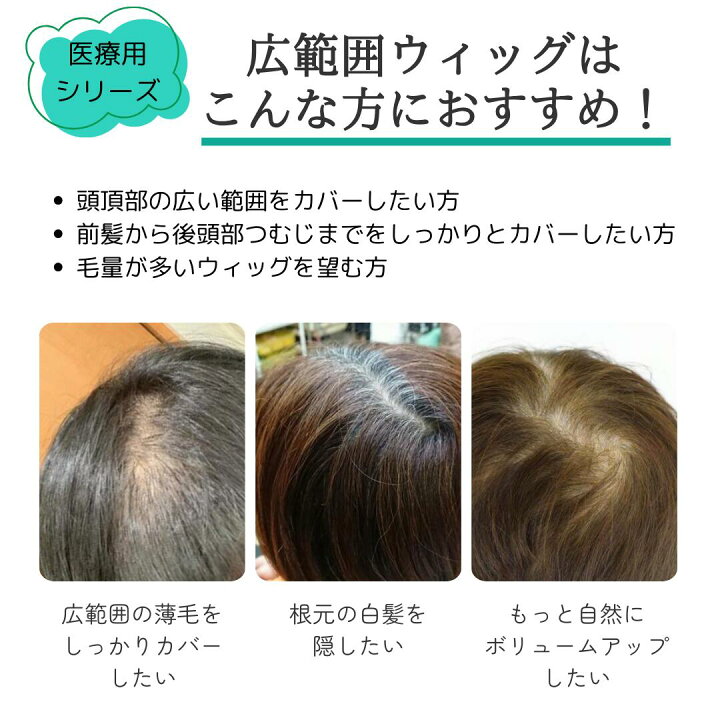 楽天市場】【試着/返品OK】 医療用 人毛100％ 広範囲ウィッグ 【12  