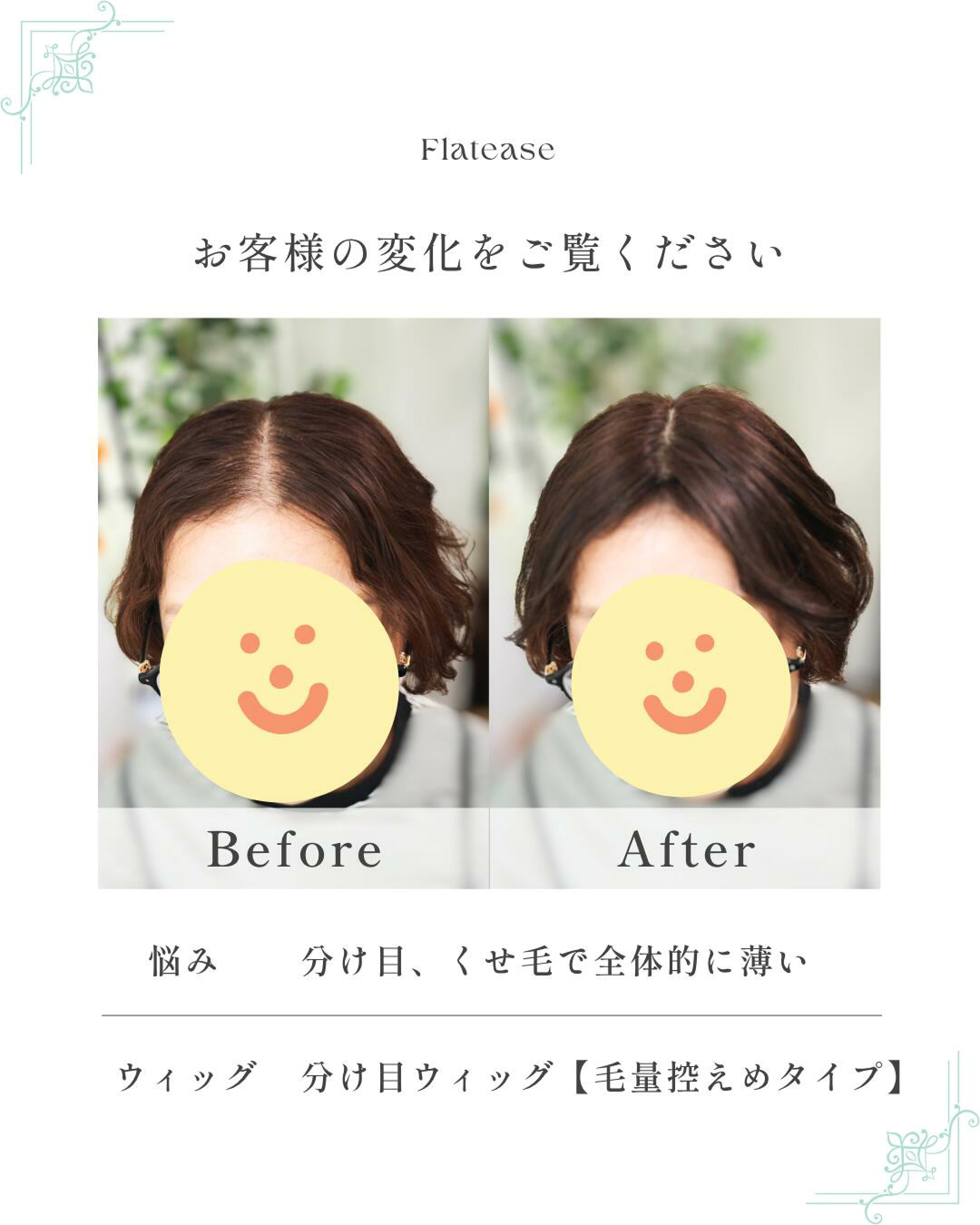 分け目ウィッグ