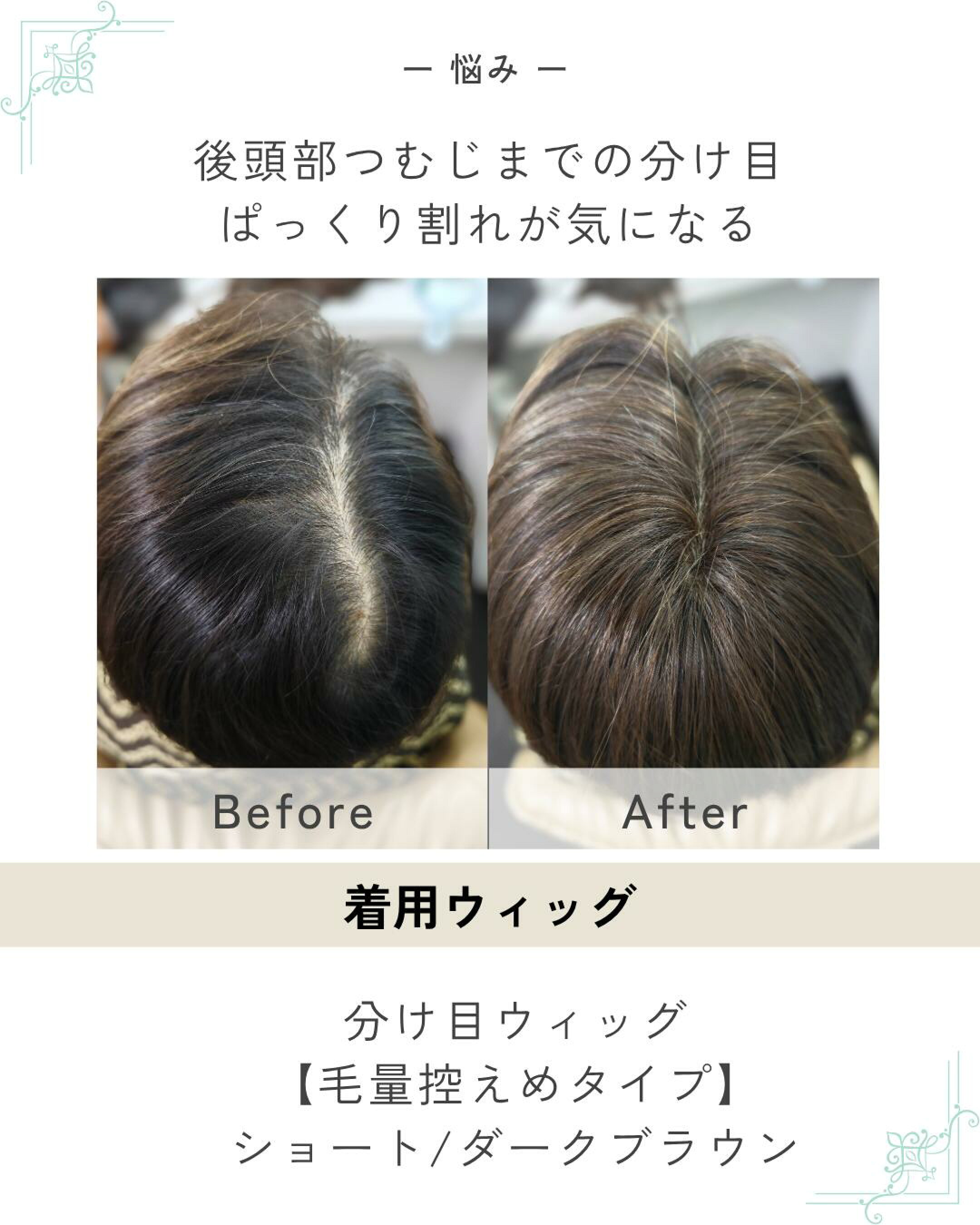 分け目ウィッグ