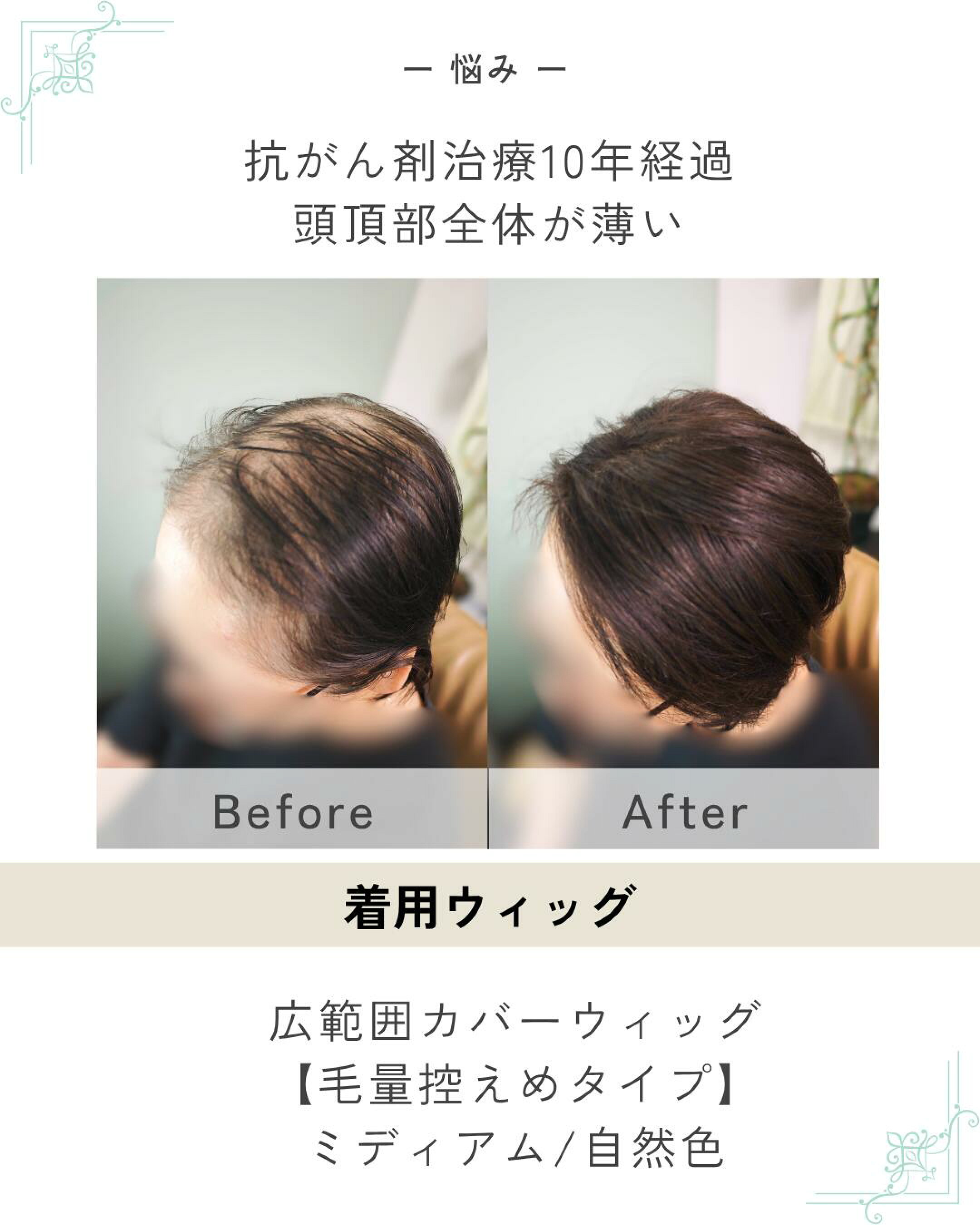 広範囲ウィッグ毛量控えめ
