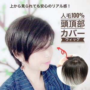 頭頂部 ウィッグの通販 価格比較 価格 Com