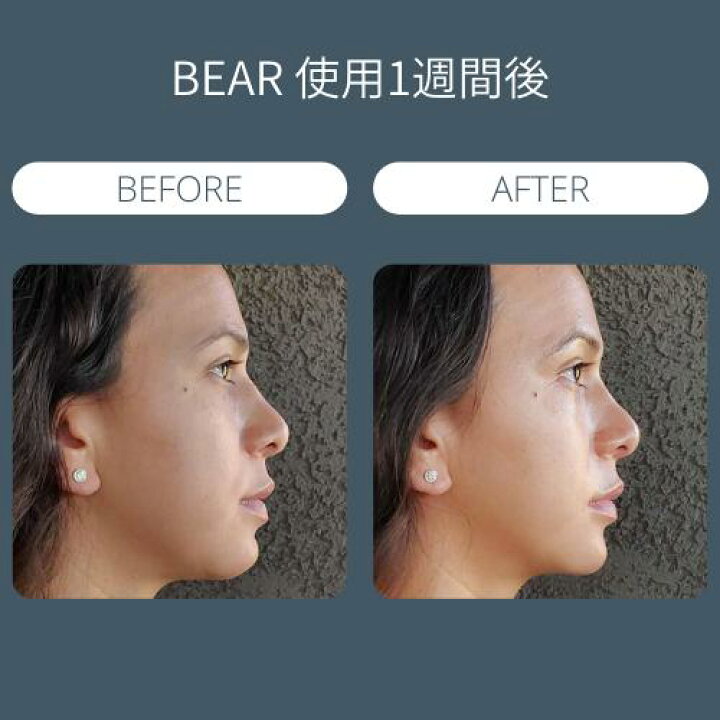 楽天市場】【50% OFF】美顔器 BEAR ベア スマート マイクロカレント 