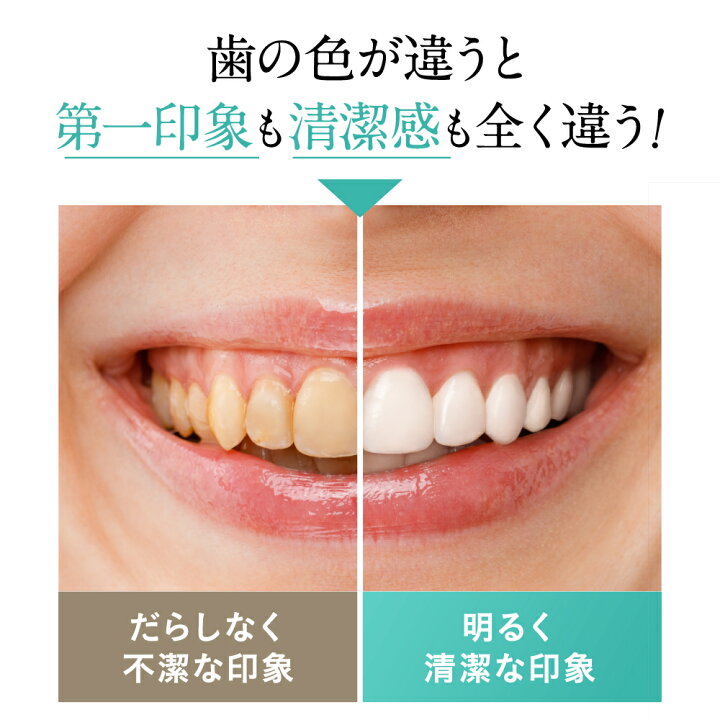 楽天市場】ホワイトニング 歯磨き粉 【 siroshu シロッシュ 】1個15g×3個 粉歯磨き粉 ヤニ取り 自宅 ホワイトニング 白い歯 :  フロムココロ