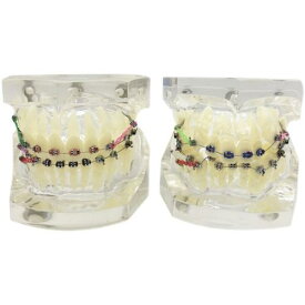 模型 口腔 歯形 歯列 モデル 歯医者 歯磨き 指導 練習 デモンストレーション 疾患展示 説明しやすい ディスプレイ 矯正