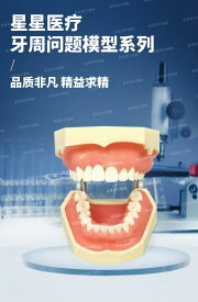 模型 口腔 歯形 歯列 モデル 歯医者 研究 教材 学習 用 歯磨き 指導 練習 デモンストレーション 疾患展示 説明しやすい 取り外し