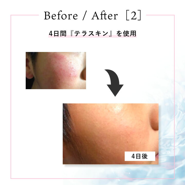 楽天市場】◇クリスティーナ テラスキン ラインリペア 30ml 美容液 
